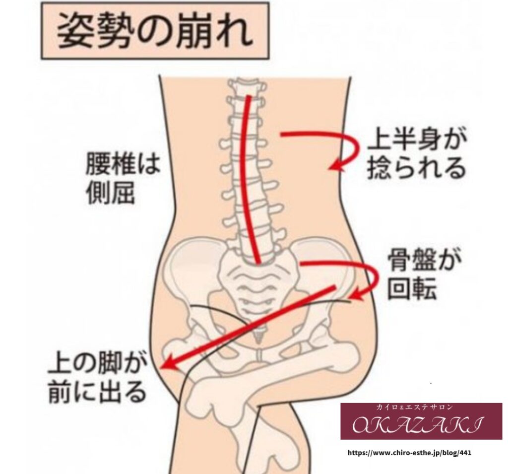 姿勢で骨盤は歪む